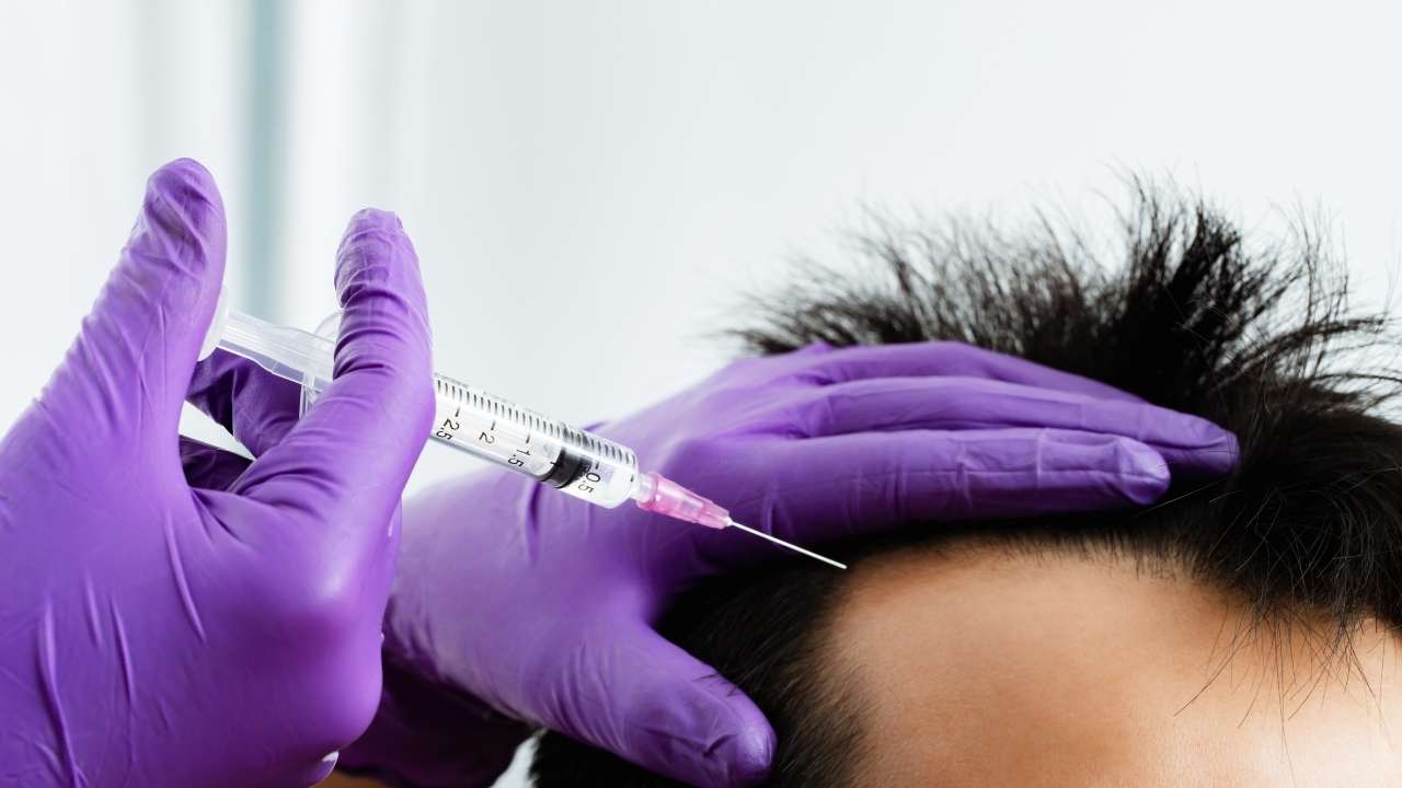 Regenera Activa Saç Tedavisi